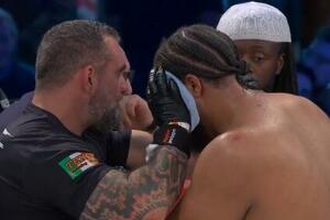 UZNEMIRUJUĆI PRIZOR! Zastrašujuća povreda oka poznatog boksera: KRV LILA na sve strane, sudija odmah PREKINUO borbu! (VIDEO)