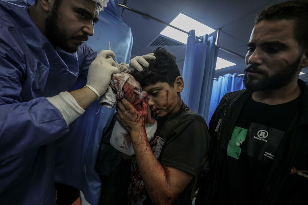 JEZIVE SCENE RANJENIH MALIŠANA POTRESAJU SVET! Pedijatri: Šokantna erupcija nasilja, zaštitite decu na Bliskom istoku! (FOTO)