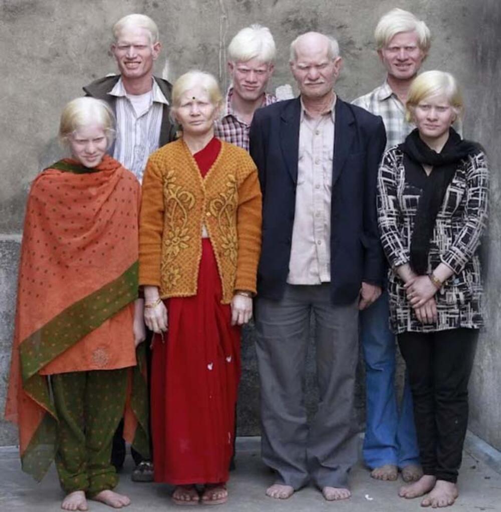 albino porodica