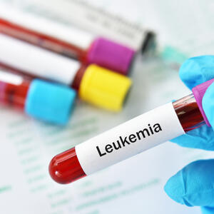 Aleksandru Ristiću postavljena je strašna dijagnoza - akutna leukemija: