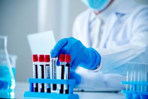 Test krvi na rak creva uskoro dostupan: Kolonoskopija i dalje zlatni standard u dijagnostici