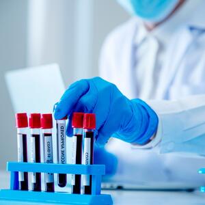 Test krvi na rak creva uskoro dostupan: Kolonoskopija i dalje zlatni standard