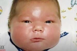 ROĐEN JE SA 7,3 KILOGRAMA I UŠAO U GINISOVU KNJIGU REKORDA: Bio je najveća beba, majka bila šokirana, a ovako danas izgleda