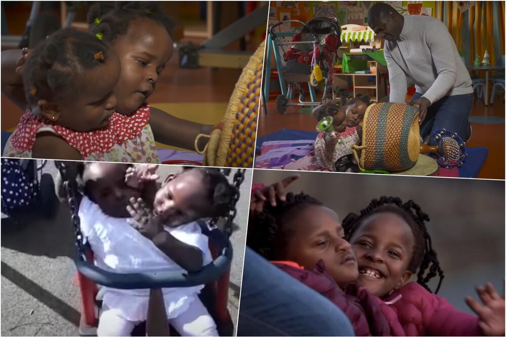 DVA SRCA I JEDAN PAR NOGU: Emotivna priča o malim ratnicama koje NE SMEJU DA SE RAZDVOJE jer bi jedna od njih UMRLA (VIDEO)