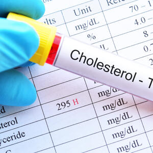 Lekari se najteže bore sa poremećajem holesterola: Cilj je da nova injekciona