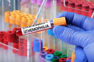 Osobe sa hemofilijom uz adekvatnu terapiju mogu da vode normalan život: Od 14. maja dostupna dva inovativna leka
